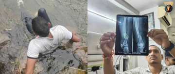 32-Year-Old Man Breaks Both Legs in 30-Foot Jump for Instagram Reel at Jhansi Dam