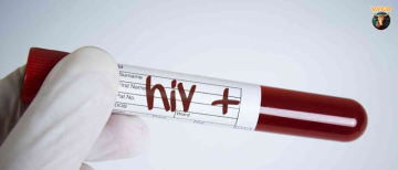 3,410 Test HIV Positive in Jamshedpur: Door-to-Door Testing Initiated